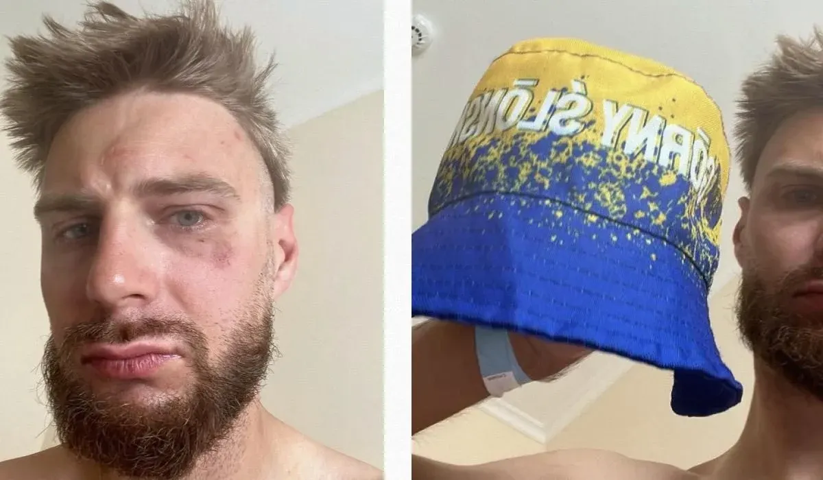 У Чехії поляка побили через панамку в кольорах Верхньої Сілезії