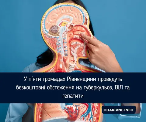 Безкоштовні медобстеження: графік виїздів у п'ять громад Рівненщини