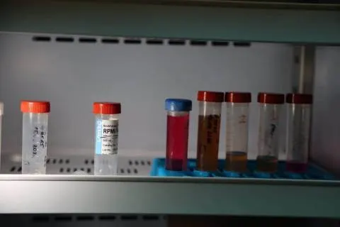 У Львівському медуніверситеті знову виготовляють ліки: відкрили фармцентр