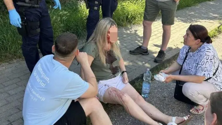 У польській Гдині невідомий побив українку палицею по голові